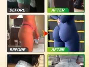 Buttocks oil Enlarge buttocks Make them fuller Rounder More upright Shape 2