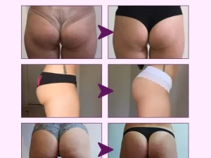 Butt Enhancement Cream Hip ock Essential Oils Fast Growth  Enhancer Breast Enlargement Body Sexy Care For Women  Lift 2