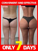 Buttocks Enlargement Oil To Increase Buttock Size Butt Lift 1
